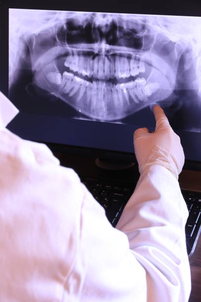 Best Emergency Dental Care for Broken or Chipped Teeth in Okolona, MS