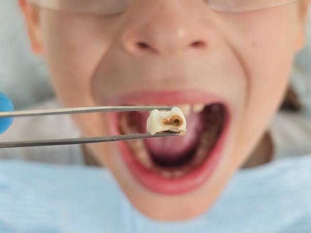 Best Emergency TMJ Treatment in Okolona, MS