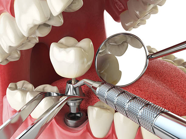 Best Emergency Gum Treatment in Okolona, MS
